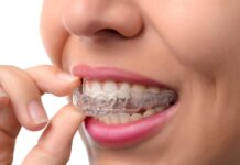 Invisalign Treatment