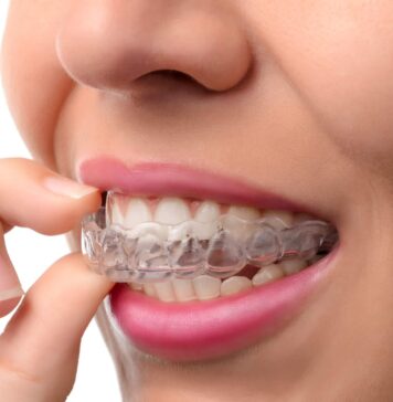 Invisalign Treatment